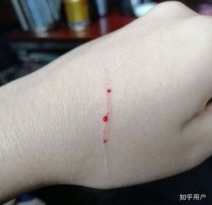 做梦被猫挠了出血了 怀孕做梦梦到被猫抓出血